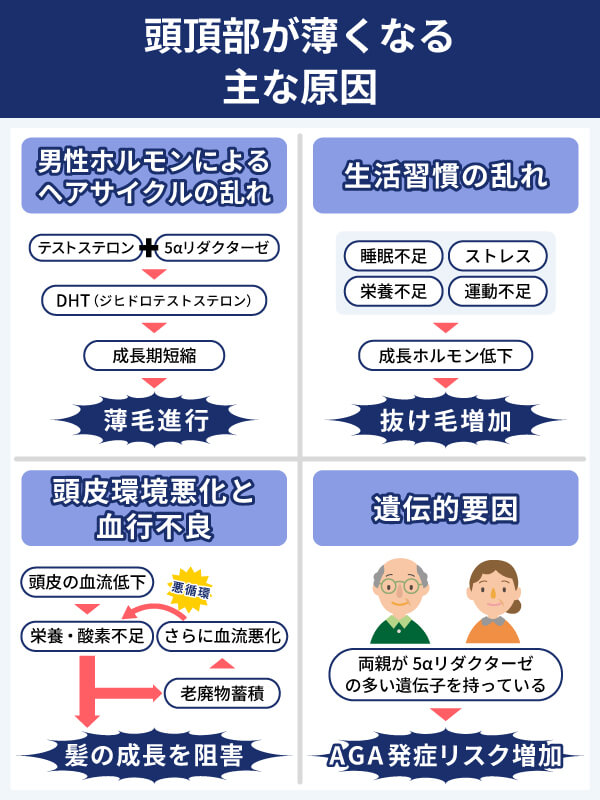 頭頂部が薄くなる主な原因