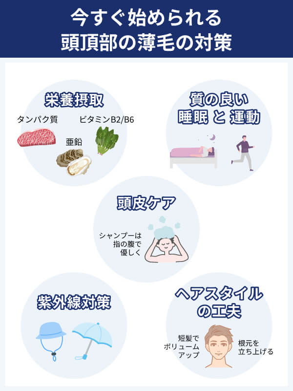 今すぐ始められる頭頂部薄毛の対策