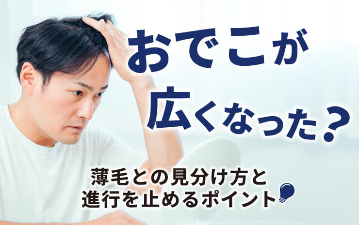 おでこが広くなった?薄毛との見分け方と進行を止めるポイント