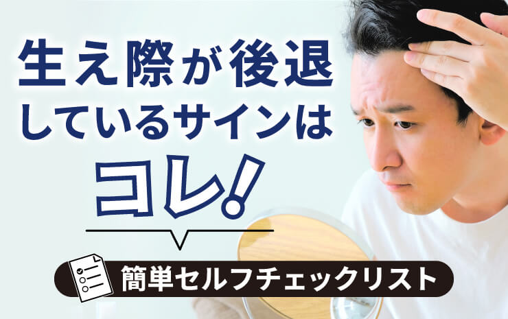 生え際が後退しているサインはコレ！簡単セルフチェックリスト