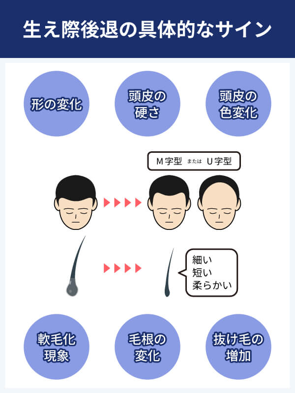 生え際後退の具体的なサイン