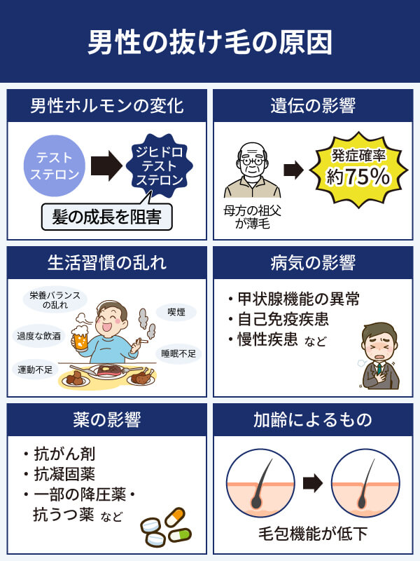 男性の抜け毛の原因