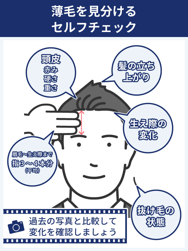 「おでこが広くなった」と薄毛を見分けるセルフチェック